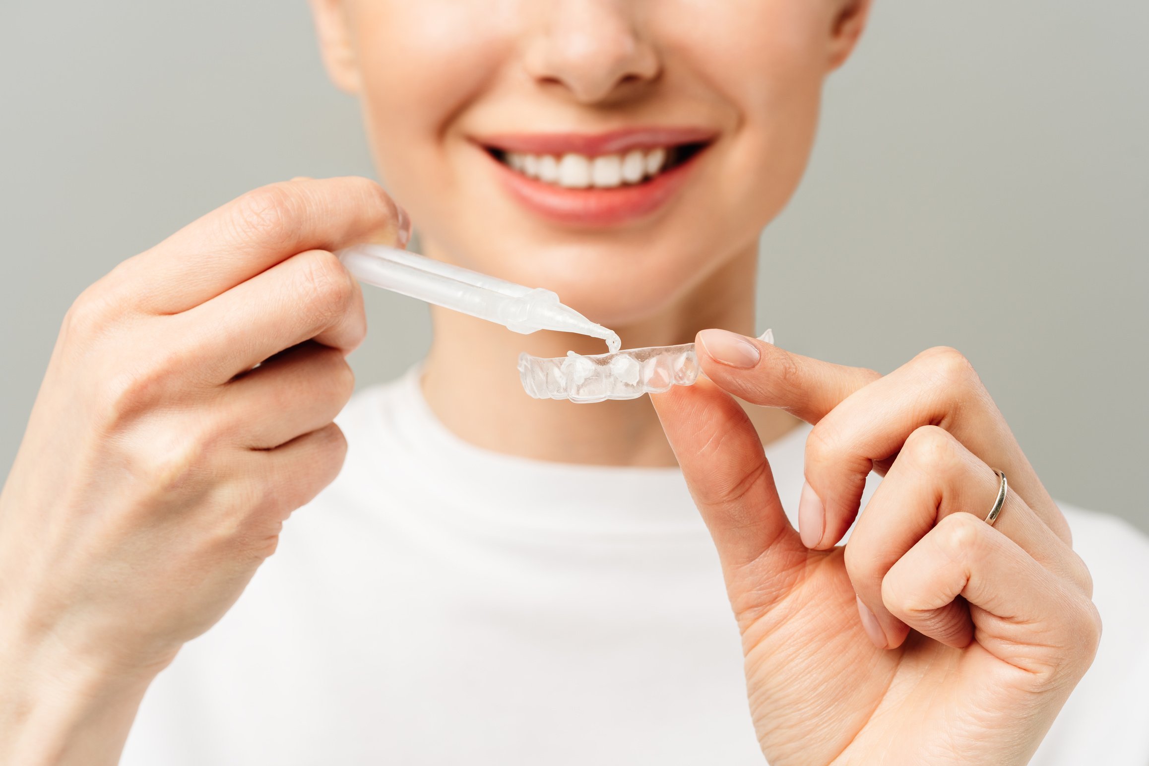 A young woman does a home teeth whitening procedure. Whitening tray with gel